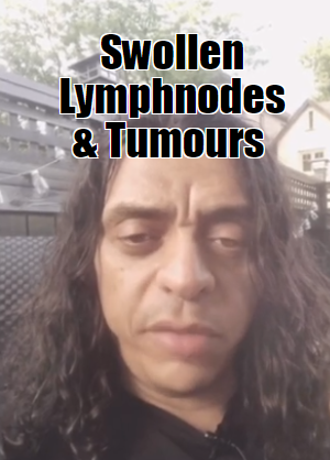 Swollen lymph nodes / tumors