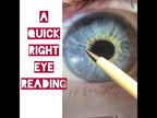 Detailed Iridology Reading
