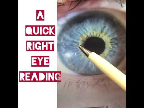 Detailed Iridology Reading