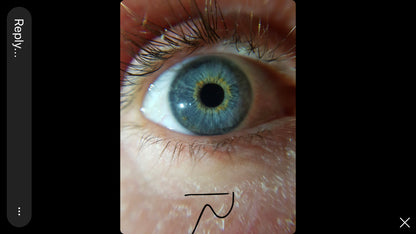 Basic Iridology Reading (PDF report)